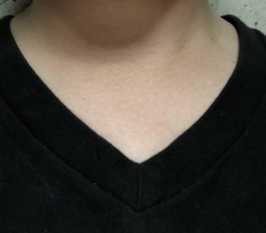 レッドキャップTシャツ首周り